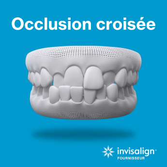 Occlusion croisée